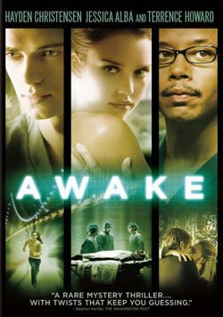 Anestezi - Awake